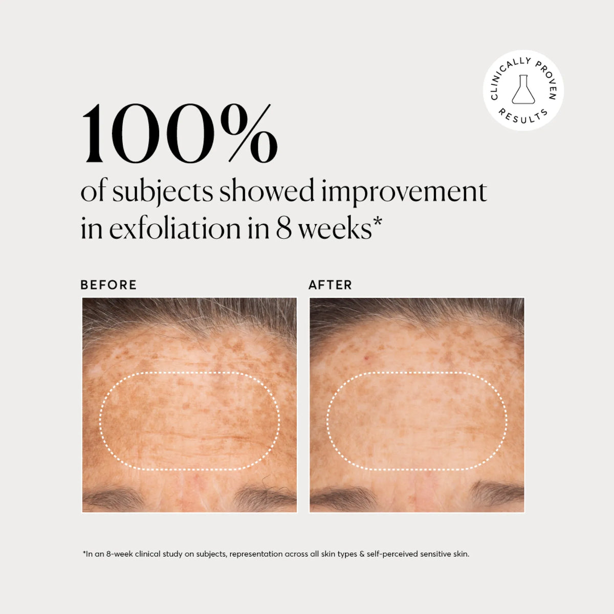 bha-liquid-exfoliant-2-d4 NATR-10027-Alt-Images-BHA-Liquid-Exfoliant-2_-03.webp