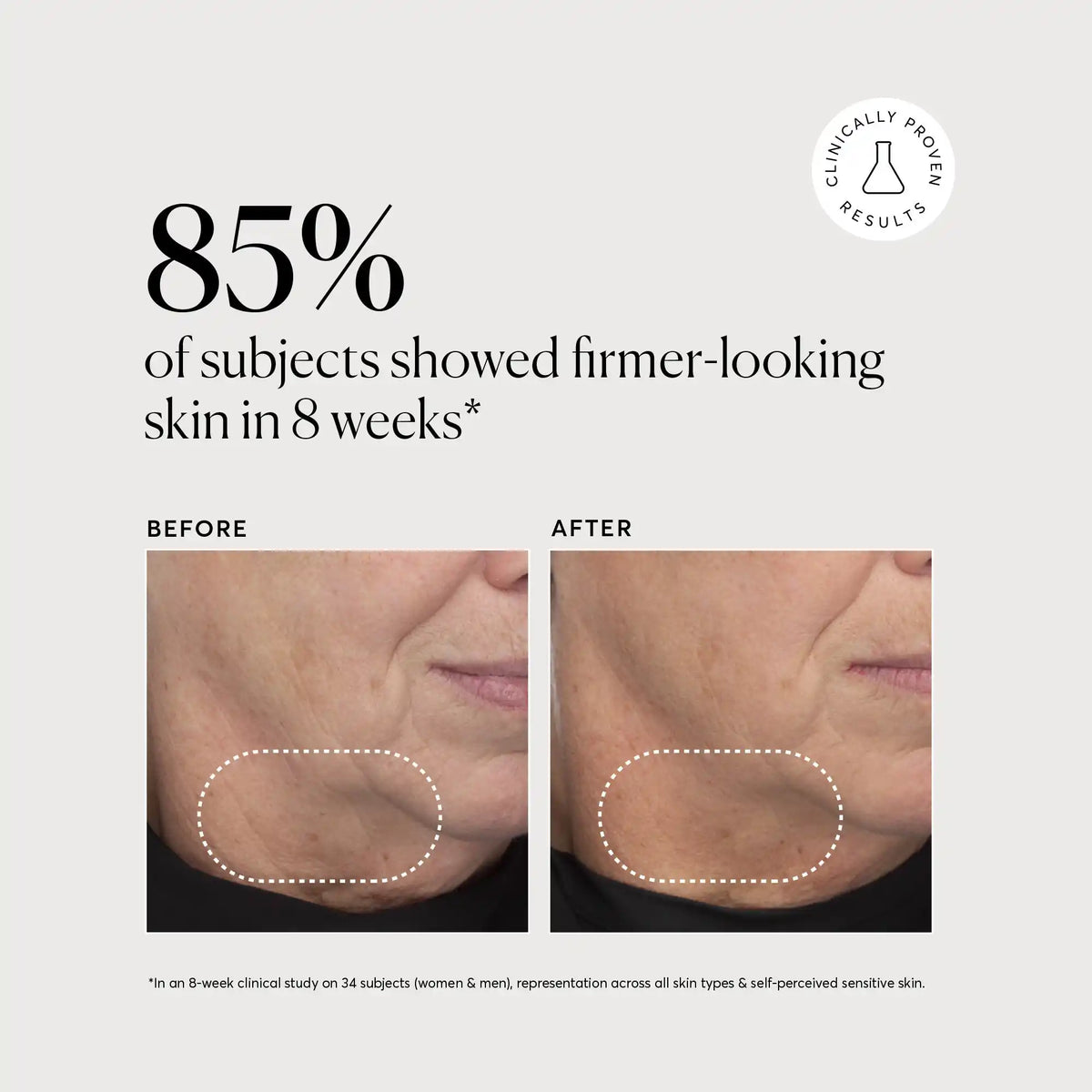 retinol-complex-serum-r7 NATR-10034-Alt-Images-Retinol-Complex-Serum-04.webp